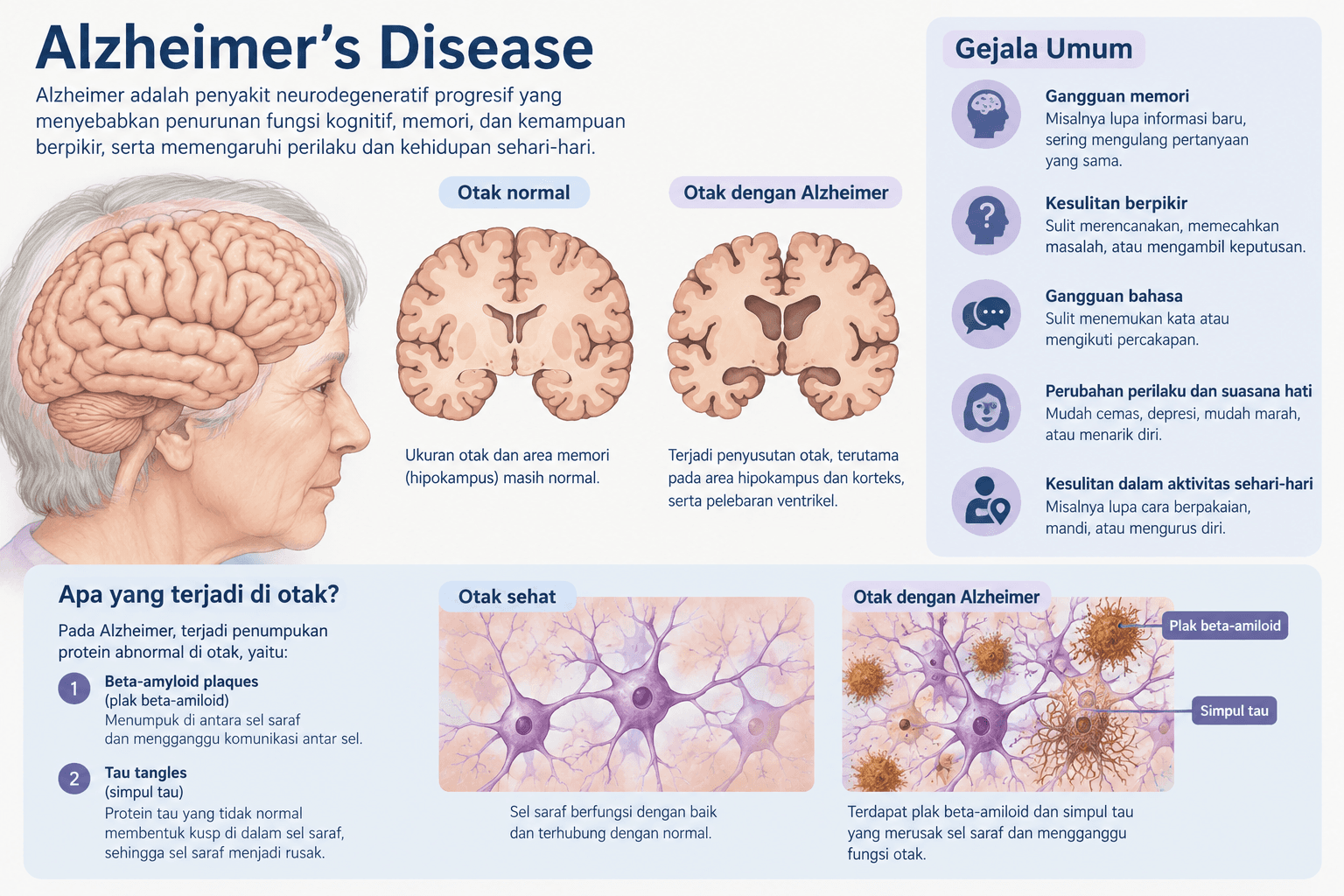 Para Peneliti Menekan Protein yang Terkait Alzheimer pada Tikus